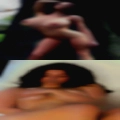 Woman cadaver