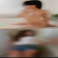 Woman in leg cast
